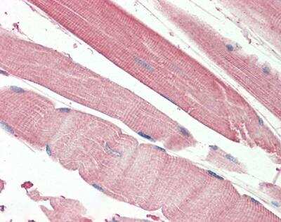 Immunohistochemistry-Paraffin: THNSL2 Antibody [NBP2-26173] - (5ug/ml) staining of paraffin embedded Human Skeletal Muscle. Steamed antigen retrieval with citrate buffer pH 6, AP-staining.