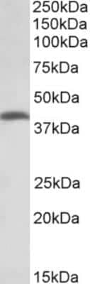 Western Blot: THNSL2 Antibody [NBP2-26173] - Staining of Human Colorectal Cancer lysate (35 ug protein in RIPA buffer). Primary incubation was 1 hour. Detected by chemiluminescence.  