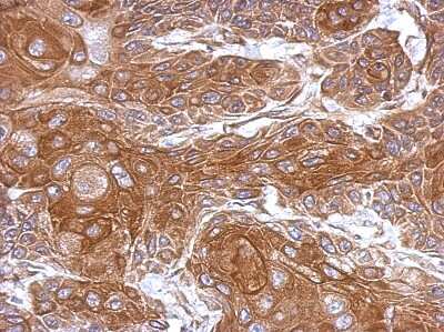 Immunohistochemistry-Paraffin: THOC5 Antibody [NBP2-20621] - Immunohistochemical analysis of paraffin-embedded Cal27 xenograft, using antibody at 1:500 dilution.