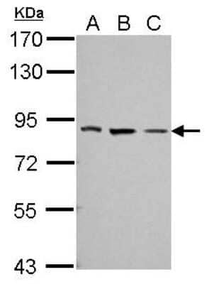 Western Blot: THOC5 Antibody [NBP2-20621] - Sample (30 ug of whole cell lysate) A: 293T B: A431 C: HeLa 7. 5% SDS PAGE gel, diluted at 1:1000.