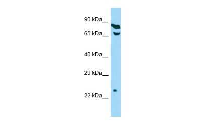 Western Blot: THOC7 Antibody [NBP2-85909] - Host: Rabbit. Target Name: THOC7. Sample Type: HepG2 Whole Cell lysates. Antibody Dilution: 1.0ug/ml