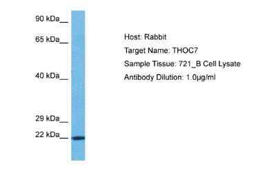 Western Blot: THOC7 Antibody [NBP2-85910] - Host: Rabbit. Target Name: THOC7. Sample Type: 721_B Whole Cell lysates. Antibody Dilution: 1.0ug/ml