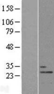 Western Blot THOC7 Overexpression Lysate