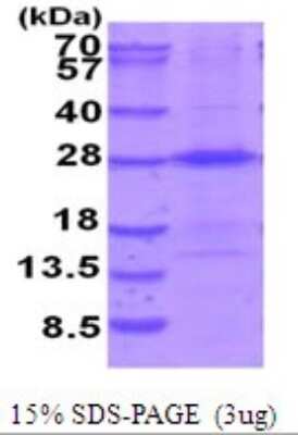 SDS-PAGE Recombinant Human THOC7 His Protein