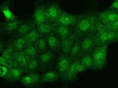 Immunocytochemistry/Immunofluorescence: THRSP Antibody [NBP2-98508] - Immunofluorescence staining of THRSP in A431 cells. Cells were fixed with 4% PFA, permeabilzed with 0.1% Triton X-100 in PBS, blocked with 10% serum, and incubated with rabbit anti-Human THRSP polyclonal antibody (dilution ratio 1:100) at 4C overnight. Then cells were stained with the Alexa Fluor$488-conjugated Goat Anti-rabbit IgG secondary antibody (green). Positive staining was localized to Nucleus and Cytoplasm.