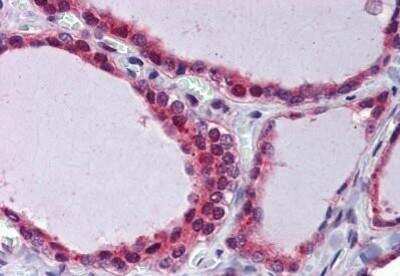 Immunohistochemistry-Paraffin: THRSP Antibody [NBP1-52541] - Analysis of anti-THRSP antibody with human thyroid at concentration 3.75 ug/ml.
