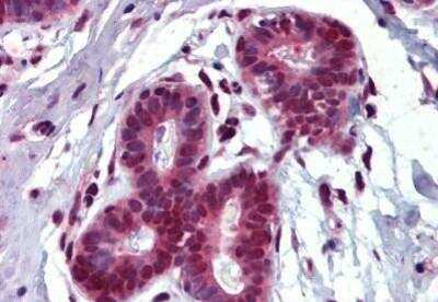 Immunohistochemistry-Paraffin: THRSP Antibody [NBP1-52541] - Analysis of anti-THRSP antibody with human breast at concentration 3.75 ug/ml.