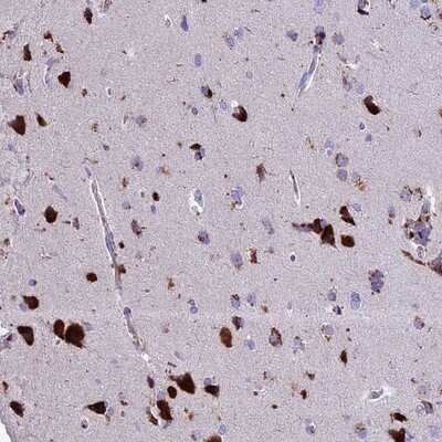 Immunohistochemistry-Paraffin: THRSP Antibody [NBP1-81290] - Staining of human cerebral cortex shows strong granular cytoplasmic positivity in neuronal cells.