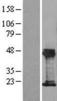 Western Blot THRSP Overexpression Lysate