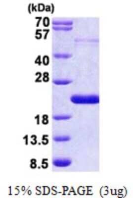 SDS-PAGE Recombinant Human THRSP His Protein