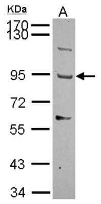Western Blot: THSD1 Antibody [NBP2-20624] - THSD1 Antibody Sample (30 ug of whole cell lysate) A: U87-MG 7. 5% SDS PAGE gel, diluted at 1:1000.