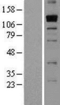 Western Blot: THSD1 Overexpression Lysate (Native) [NBP2-06785] - THSD1 Overexpression Lysate (Native) Left-Empty vector transfected control cell lysate (HEK293 cell lysate); Right -Over-expression Lysate for Thrombospondin 1.