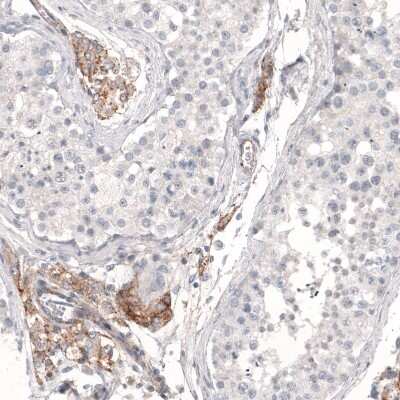 Immunohistochemistry-Paraffin: THSD7A Antibody (CL3778) [NBP2-61638] - Staining of human testis shows moderate membranous positivity in Leydig cells.