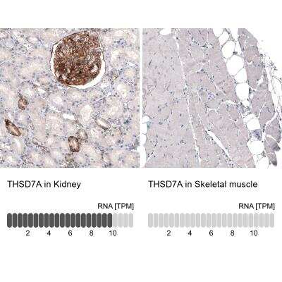 Immunohistochemistry-Paraffin: THSD7A Antibody (CL3778) [NBP2-61638] - Staining in human kidney and skeletal muscle tissues. Corresponding THSD7A RNA-seq data are presented for the same tissues.