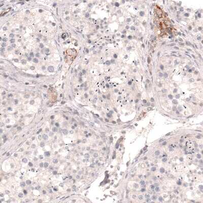 Immunohistochemistry-Paraffin: THSD7A Antibody (CL3779) [NBP2-61639] - Staining of human testis shows moderate membranous positivity in Leydig cells.