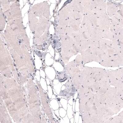 Immunohistochemistry-Paraffin: THSD7A Antibody (CL3779) [NBP2-61639] - Staining of human skeletal muscle shows no positivity in striated muscle fibers as expected.