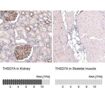 Immunohistochemistry-Paraffin: THSD7A Antibody (CL3779) [NBP2-61639] - Staining in human kidney and skeletal muscle tissues. Corresponding THSD7A RNA-seq data are presented for the same tissues.