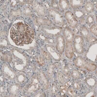 Immunohistochemistry-Paraffin: THSD7A Antibody [NBP1-93612] - Staining of human kidney shows moderate membranous positivity in glomerular cells.
