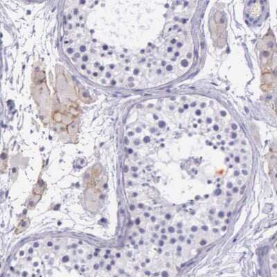 Immunohistochemistry-Paraffin: THSD7A Antibody [NBP1-93612] - Staining of human testis shows weak membranous positivity in Leydig cells.