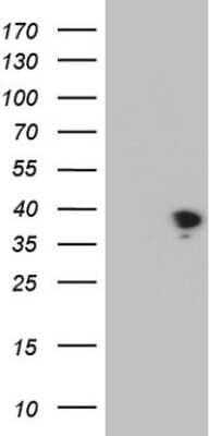 Western Blot: THTPA Antibody (13E3) [NBP2-46122] - Analysis of HEK293T cells were transfected with the pCMV6-ENTRY control (Left lane) or pCMV6-ENTRY THTPA .