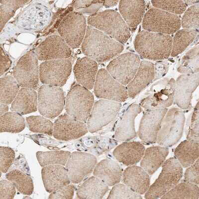 Immunohistochemistry-Paraffin: THTPA Antibody [NBP1-80686] - Staining of human skeletal muscle shows moderate cytoplasmic positivity in myocytes.