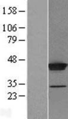 Western Blot: THUMPD1 Overexpression Lysate (Adult Normal) [NBL1-16901] Left-Empty vector transfected control cell lysate (HEK293 cell lysate); Right -Over-expression Lysate for THUMPD1.