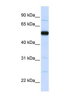 Western Blot: THUMPD2 Antibody [NBP1-55086] - Titration: 0.2-1 ug/ml, Positive Control: Human Placenta.