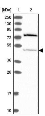 Western Blot: THUMPD2 Antibody [NBP1-92504] - Lane 1: Marker  [kDa] 250, 130, 95, 72, 55, 36, 28, 17, 10.  Lane 2: Human cell line RT-4