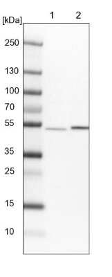 Western Blot: THUMPD2 Antibody [NBP1-92504] - Lane 1: NIH-3T3 cell lysate (Mouse embryonic fibroblast cells) Lane 2: NBT-II cell lysate (Rat Wistar bladder tumour cells)