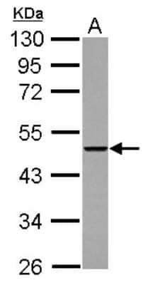 Western Blot: THUMPD2 Antibody [NBP2-20625] - Sample (30 ug of whole cell lysate) A: A431 10% SDS PAGE gel, diluted at 1:5000.