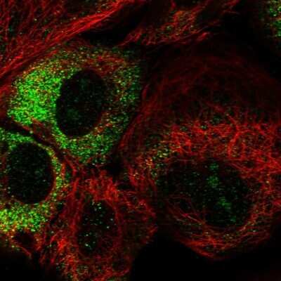 Immunocytochemistry/Immunofluorescence: THUMPD3 Antibody [NBP1-85132] - Staining of human cell line A-431 shows localization to nucleoli & cytosol. Antibody staining is shown in green.
