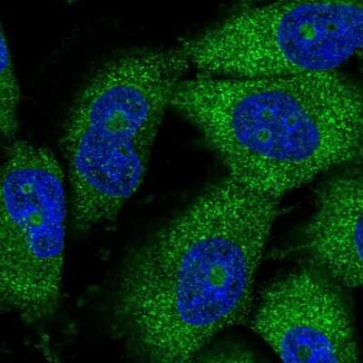 Immunocytochemistry/Immunofluorescence: THUMPD3 Antibody [NBP2-38287] - Staining of human cell line U-251 MG shows localization to nucleoli & cytosol.