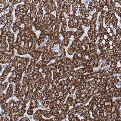 Immunohistochemistry-Paraffin: THUMPD3 Antibody [NBP1-85132] - Staining of human liver shows strong cytoplasmic positivity(granular pattern) in hepatocytes.