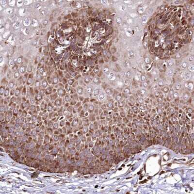 Immunohistochemistry-Paraffin: THUMPD3 Antibody [NBP2-38287] - Staining of human esophagus shows strong cytoplasmic positivity in squamous epithelial cells.