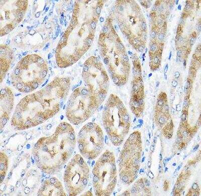Immunohistochemistry-Paraffin: THUMPD3 Antibody [NBP2-93482] - Mouse kidney using THUMPD3 Rabbit pAb at dilution of 1:200 (40x lens).