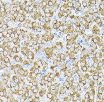 Immunohistochemistry-Paraffin: THUMPD3 Antibody [NBP2-93482] - Rat ovary using THUMPD3 Rabbit pAb at dilution of 1:200 (40x lens).