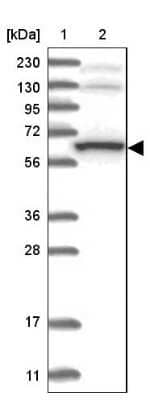 Western Blot THUMPD3 Antibody - BSA Free