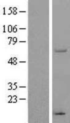Western Blot: THUMPD3 Overexpression Lysate (Adult Normal) [NBP2-09391] Left-Empty vector transfected control cell lysate (HEK293 cell lysate); Right -Over-expression Lysate for THUMPD3.
