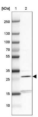 Western Blot: THYN1 Antibody [NBP2-32645] - Lane 1: Marker [kDa] 250, 130, 100, 70, 55, 35, 25, 15, 10Lane 2: Human cell line HEL