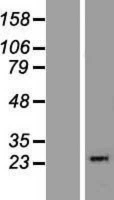 Western Blot: THYN1 Overexpression Lysate (Adult Normal) [NBP2-09197] Left-Empty vector transfected control cell lysate (HEK293 cell lysate); Right -Over-expression Lysate for THYN1.