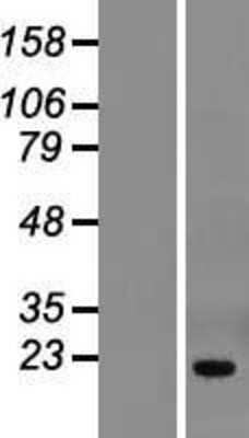 Western Blot: THYN1 Overexpression Lysate (Adult Normal) [NBP2-10096] Left-Empty vector transfected control cell lysate (HEK293 cell lysate); Right -Over-expression Lysate for THYN1.