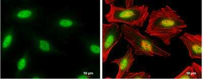 Immunocytochemistry/Immunofluorescence: TIA1 Antibody [NBP1-33452] -  HeLa cells were fixed in 4% paraformaldehyde at RT for 15 min. Green: TIA1 stained by TIA1 antibody [N1N3] diluted at 1:500. Red: phalloidin, a cytoskeleton marker, diluted at 1:100. Scale bar= 10um.