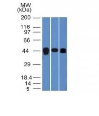 Western Blot: TIA1 Antibody (TIA1/1313) [NBP2-53336] - Western Blot of HepG2, PC3 and HeLa Cell Lysates with TIA1 Monoclonal Antibody (TIA1/1313).
