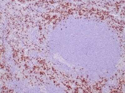 Immunohistochemistry-Paraffin: TIA1 Antibody (TIA1/1352R) [NBP3-13791] - Formalin-fixed, paraffin-embedded human spleen stained with TIA1 antibody (TIA1/1352R). HIER: Tris/EDTA, pH9.0, 45min. HRP-polymer, 30min. DAB, 5min.