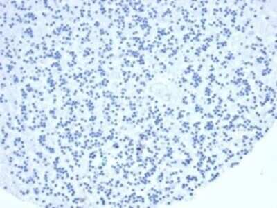 Immunohistochemistry-Paraffin: TIA1 Antibody (TIA1/1352R) [NBP3-13791] - IHC analysis of formalin-fixed, paraffin-embedded human brain. Negative tissue control using TIA1 antibody (TIA1/1352R) at 2ug/ml in PBS for 30min RT. HIER: Tris/EDTA, pH9.0, 45min. HRP-polymer, 30min. DAB, 5min.
