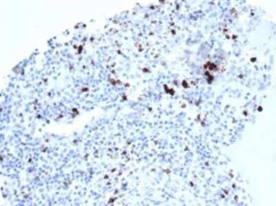Immunohistochemistry-Paraffin: TIA1 Antibody (TIA1/1352R) [NBP3-13791] - Formalin-fixed, paraffin-embedded human tonsil stained with TIA1 antibody (TIA1/1352R).  HIER: Tris/EDTA, pH9.0, 45min. HRP-polymer, 30min. DAB, 5min.