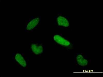 Immunocytochemistry/Immunofluorescence: TIAL1 Antibody [H00007073-B01P] - Analysis of purified antibody to TIAL1 on HeLa cell. (antibody concentration 10 ug/ml)