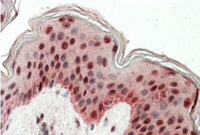 Immunohistochemistry-Paraffin: TIAL1 Antibody [NBP1-49832] - Staining of Human Skin. Steamed antigen retrieval with citrate buffer pH 6, AP-staining.