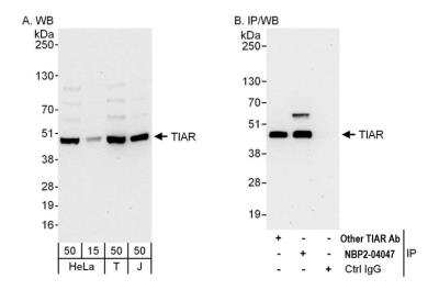 Western Blot: TIAL1 Antibody [NBP2-04047] - Detection of human TIAR by western blot and immunoprecipitation. Samples: Whole cell lysate from HeLa (15 and 50 ug for WB; 1 mg for IP, 20% of IP loaded), HEK293T (T; 50 ug) and Jurkat (J; 50 ug) cells. Antibodies: Affinity purified rabbit anti-TIAR antibody NBP2-04047 used for WB at 0.1 ug/ml (A) and 1 ug/ml (B) and used for IP at 6 ug/mg lysate. TIAR was also immunoprecipitated by another rabbit anti-TIAR antibody, which recognizes an upstream epitope. Detection: Chemiluminescence with exposure times of 30 seconds (A and B).