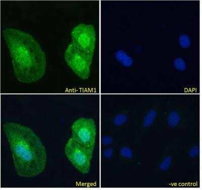 Immunocytochemistry/ Immunofluorescence TIAM1 Antibody